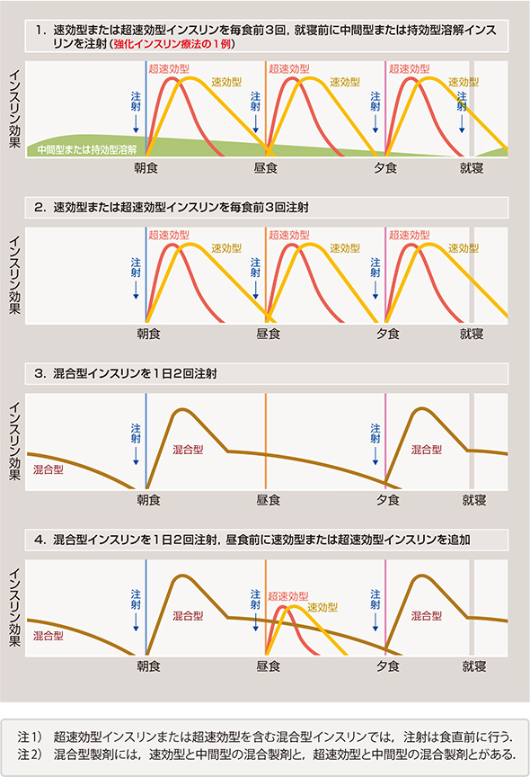 インスリン注射の例