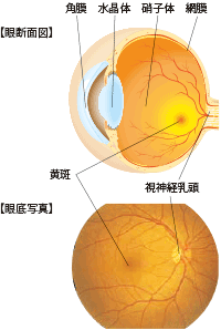 病期分類:糖尿病網膜症なし イメージ